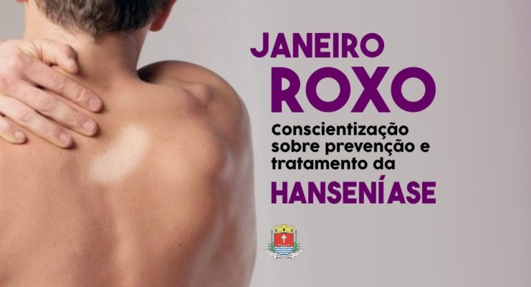 Janeiro Roxo: Perguntas frequentes sobre a Hanseníase - Escola